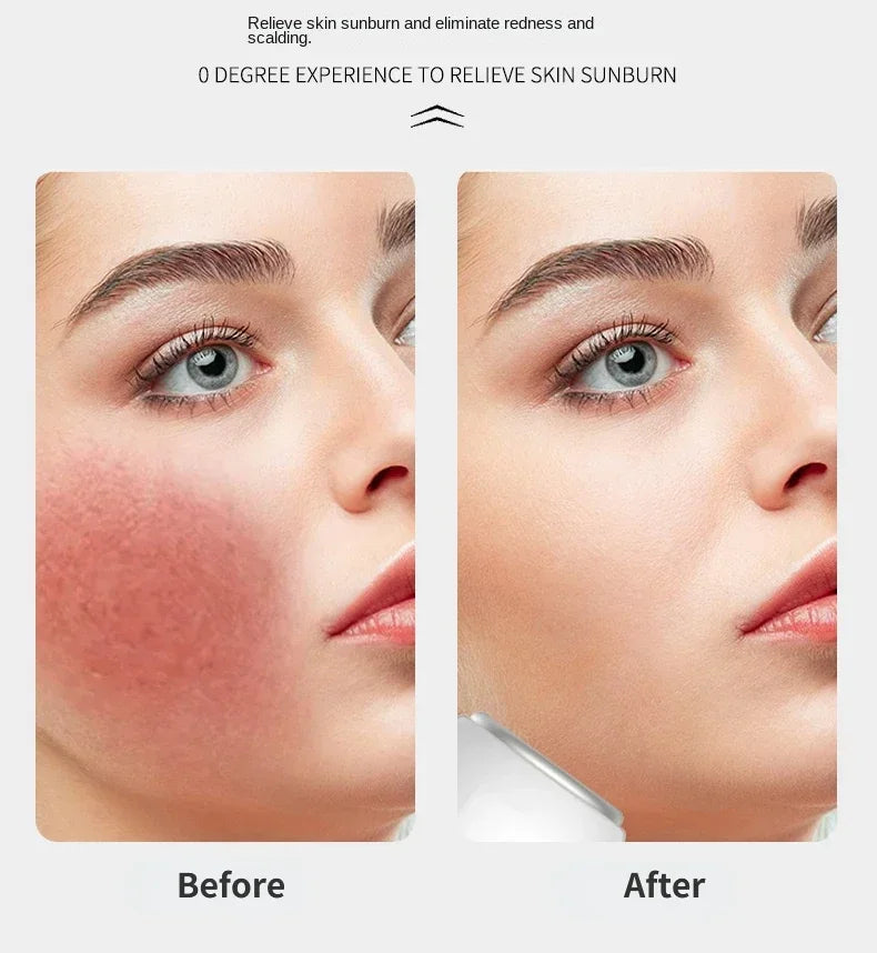 Facial Deep Tissue Cooling Ice Roller